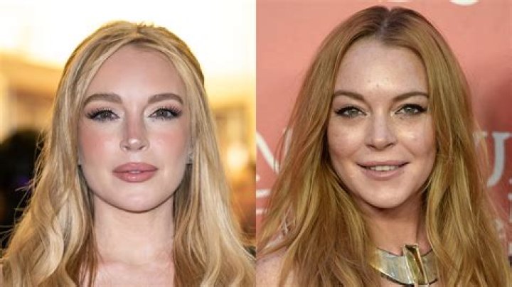 Lindsay Lohan's Journey With Plastic Surgery